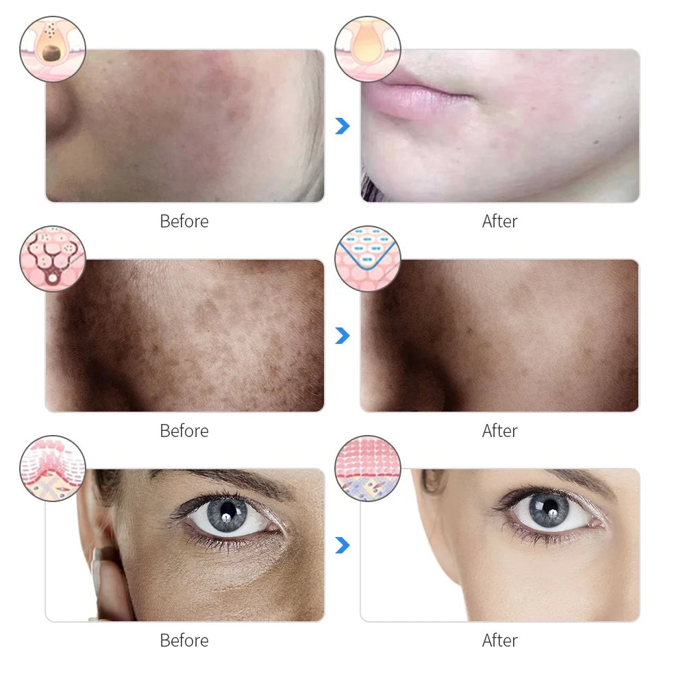 LifeLuxe™ Advanced LED Skincare Therapy Mask